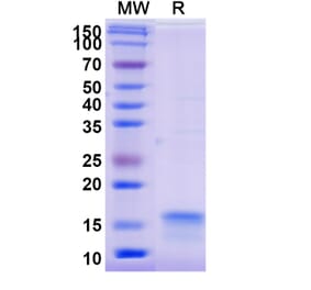 SDS-PAGE - Anti-IL12RB2 Nanobody [SAA1301] (A337978) - Antibodies.com