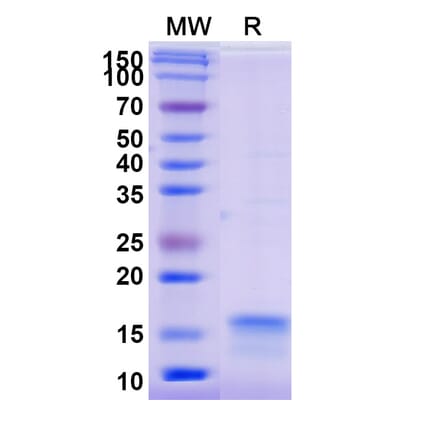 SDS-PAGE - Anti-IL12RB2 Nanobody [SAA1301] (A337978) - Antibodies.com