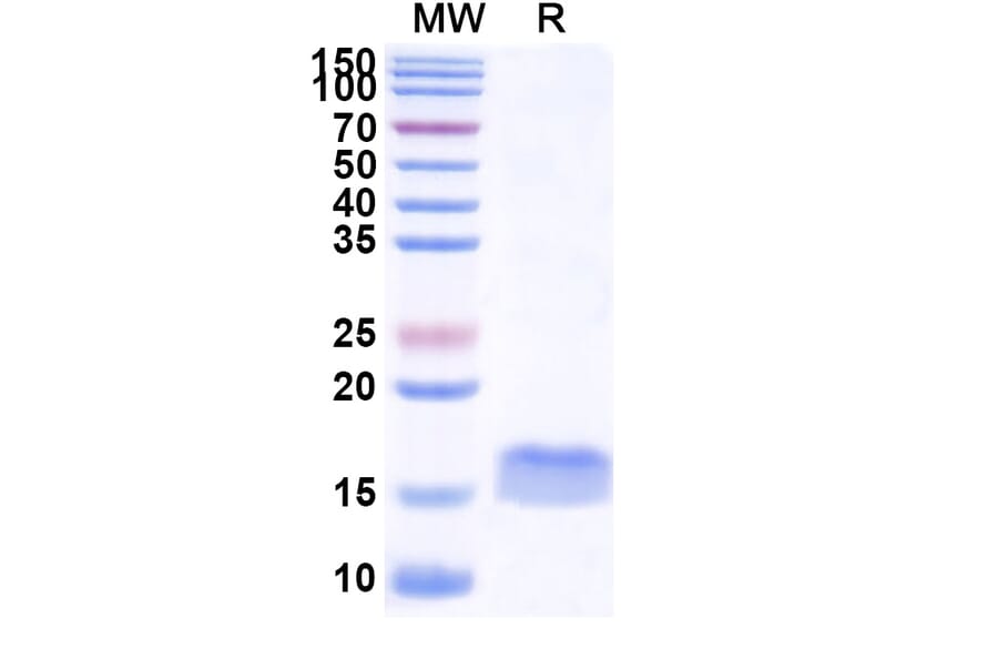 SDS-PAGE - Anti-PD-L2 Nanobody [SAA1281] (A337979) - Antibodies.com
