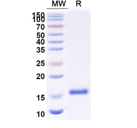 SDS-PAGE - Anti-Sclerostin Nanobody [SAA1265] (A337980) - Antibodies.com