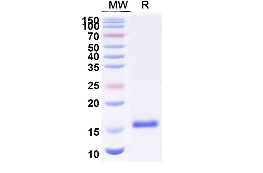 SDS-PAGE - Anti-Sclerostin Nanobody [SAA1265] (A337980) - Antibodies.com