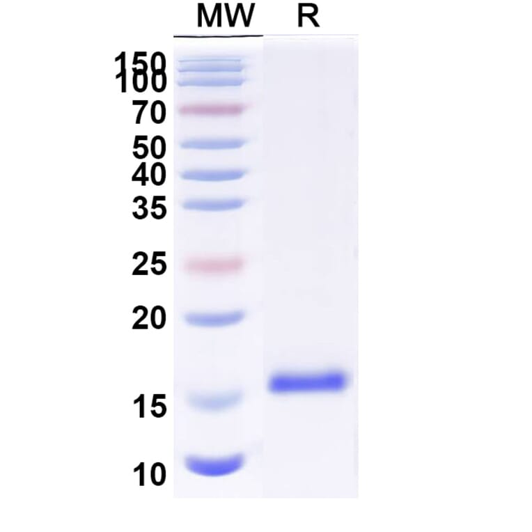 SDS-PAGE - Anti-Sclerostin Nanobody [SAA1265] (A337980) - Antibodies.com