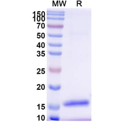 SDS-PAGE - Anti-DC-SIGN Nanobody [SAA1327] (A337983) - Antibodies.com