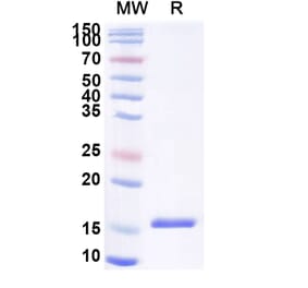 SDS-PAGE - Anti-DLL4 Nanobody [SAA1284] (A337985) - Antibodies.com