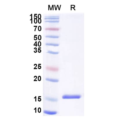 SDS-PAGE - Anti-DLL4 Nanobody [SAA1284] (A337985) - Antibodies.com