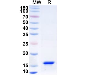 SDS-PAGE - Anti-IL-17RB Nanobody [SAA1267] (A337986) - Antibodies.com