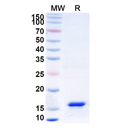 SDS-PAGE - Anti-IL-17RB Nanobody [SAA1267] (A337986) - Antibodies.com