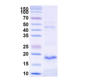 SDS-PAGE - Anti-TREM2 Nanobody [SAA1137] (A337987) - Antibodies.com
