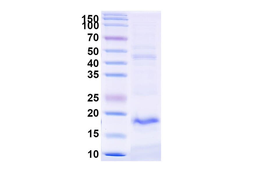 SDS-PAGE - Anti-TREM2 Nanobody [SAA1137] (A337987) - Antibodies.com