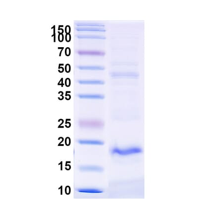 SDS-PAGE - Anti-TREM2 Nanobody [SAA1137] (A337987) - Antibodies.com