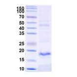 SDS-PAGE - Anti-TREM2 Nanobody [SAA1137] (A337987) - Antibodies.com