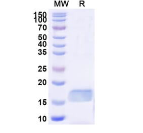 SDS-PAGE - Anti-ASC Nanobody [SAA1187] (A337992) - Antibodies.com