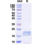 SDS-PAGE - Anti-ASC Nanobody [SAA1187] (A337992) - Antibodies.com
