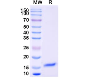 SDS-PAGE - Anti-Notch3 Nanobody [SAA1288] (A337994) - Antibodies.com