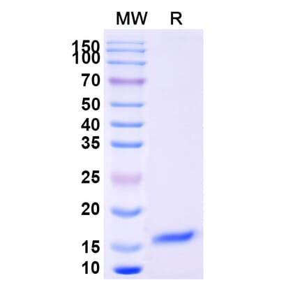 SDS-PAGE - Anti-Notch3 Nanobody [SAA1288] (A337994) - Antibodies.com
