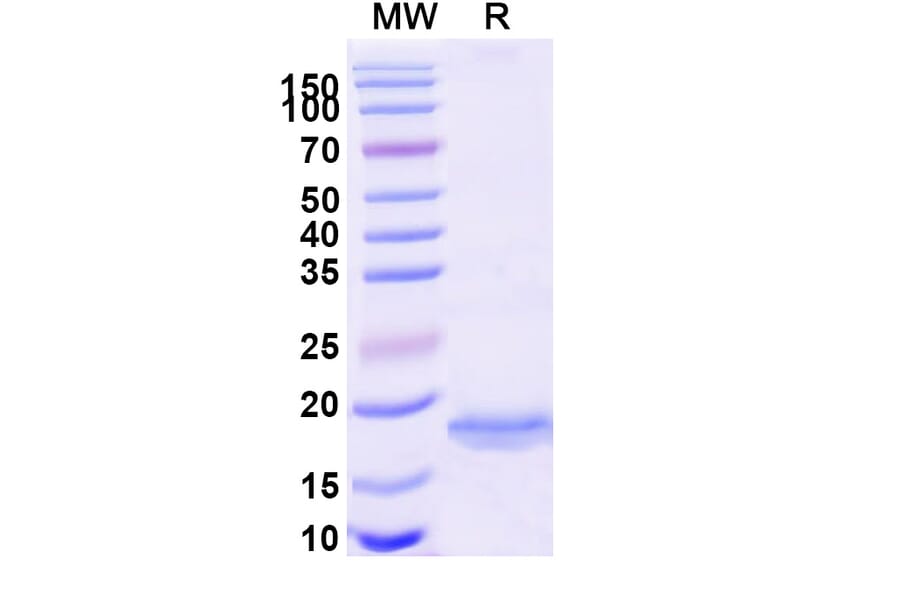SDS-PAGE - Anti-MOK Protein Kinase Nanobody [SAA1290] (A337996) - Antibodies.com