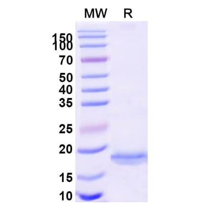SDS-PAGE - Anti-MOK Protein Kinase Nanobody [SAA1290] (A337996) - Antibodies.com