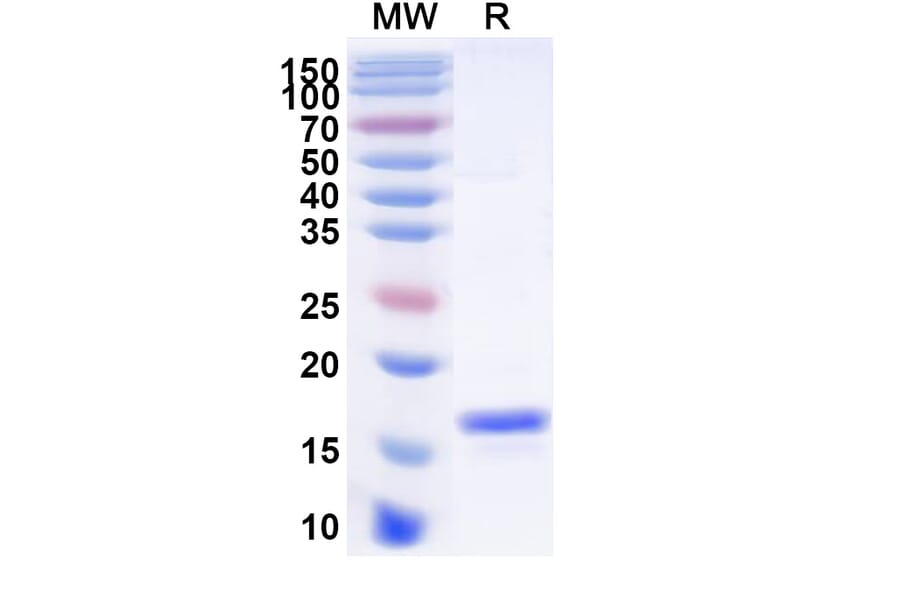 SDS-PAGE - Anti-Angiopoietin 4 Nanobody [SAA1257] (A337999) - Antibodies.com