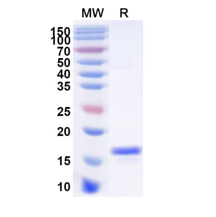 SDS-PAGE - Anti-Angiopoietin 4 Nanobody [SAA1257] (A337999) - Antibodies.com