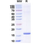SDS-PAGE - Anti-BACE2 Nanobody [SAA1185] (A338000) - Antibodies.com