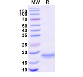 SDS-PAGE - Anti-BACE2 Nanobody [SAA1030] (A338003) - Antibodies.com