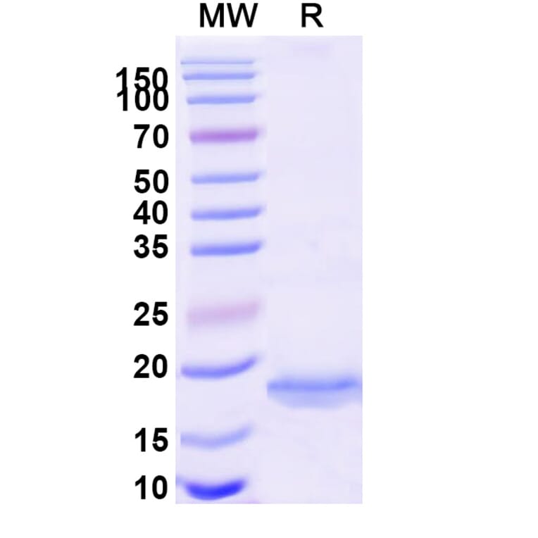 SDS-PAGE - Anti-BACE2 Nanobody [SAA1030] (A338003) - Antibodies.com