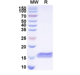 SDS-PAGE - Anti-BACE2 Nanobody [SAA1031] (A338004) - Antibodies.com