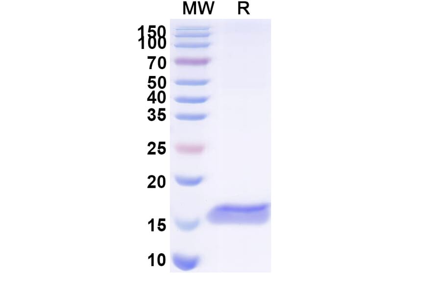 SDS-PAGE - Anti-BACE2 Nanobody [SAA1031] (A338004) - Antibodies.com