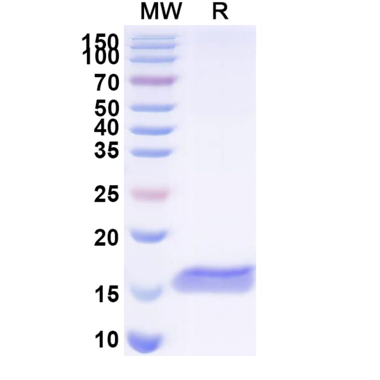SDS-PAGE - Anti-BACE2 Nanobody [SAA1031] (A338004) - Antibodies.com