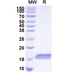 SDS-PAGE - Anti-BACE2 Nanobody [SAA1031] (A338004) - Antibodies.com