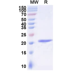 SDS-PAGE - Anti-IgE Nanobody [SAA1191] (A338005) - Antibodies.com