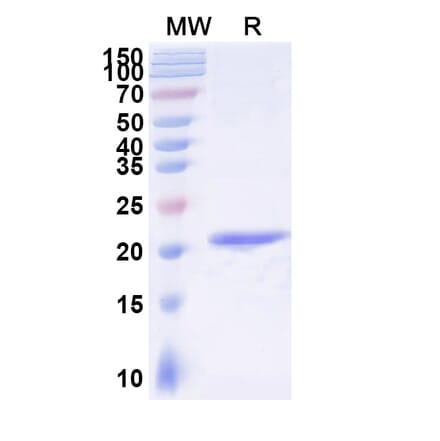 SDS-PAGE - Anti-IgE Nanobody [SAA1191] (A338005) - Antibodies.com