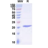 SDS-PAGE - Anti-IgE Nanobody [SAA1191] (A338005) - Antibodies.com