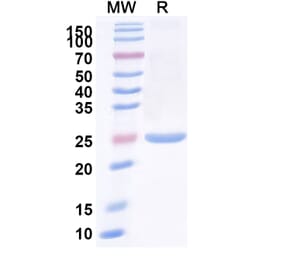 SDS-PAGE - Anti-IgM Nanobody [SAA1253] (A338006) - Antibodies.com
