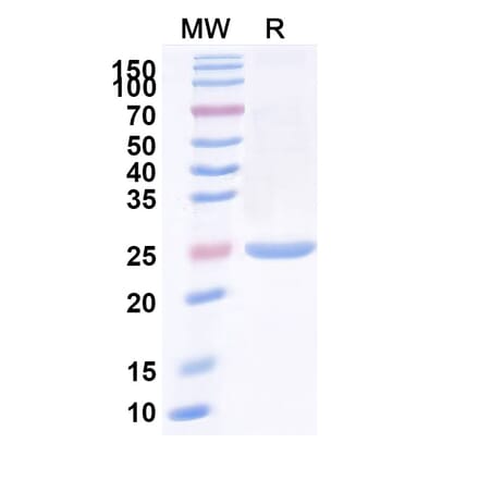 SDS-PAGE - Anti-IgM Nanobody [SAA1253] (A338006) - Antibodies.com