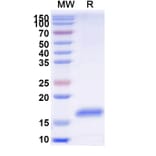 SDS-PAGE - Anti-Dectin 1 Nanobody [SAA1364] (A338007) - Antibodies.com