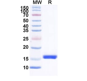 SDS-PAGE - Anti-CLEC9A Nanobody [SAA1331] (A338008) - Antibodies.com