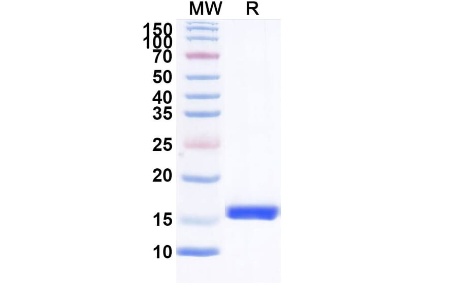 SDS-PAGE - Anti-CLEC9A Nanobody [SAA1331] (A338008) - Antibodies.com