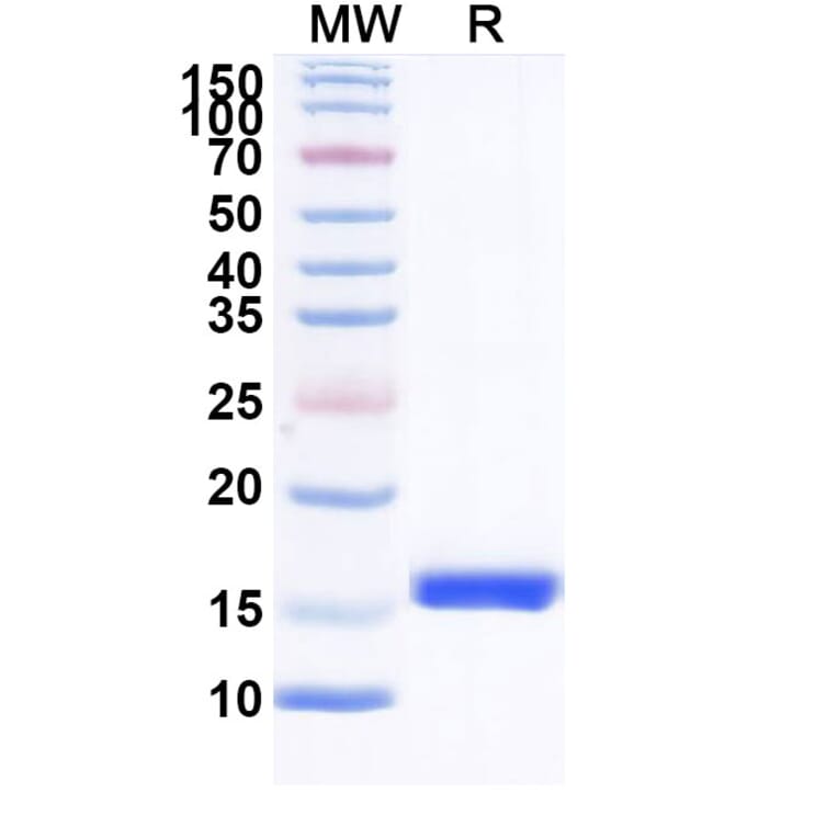 SDS-PAGE - Anti-CLEC9A Nanobody [SAA1331] (A338008) - Antibodies.com