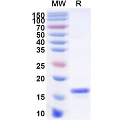 SDS-PAGE - Anti-VSIG4 Nanobody [SAA1085] (A338009) - Antibodies.com