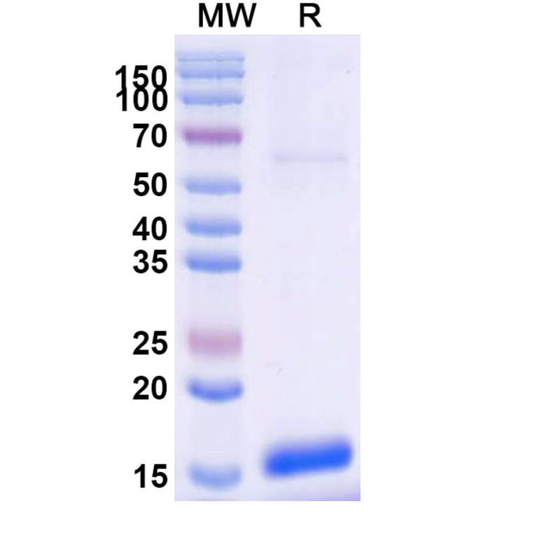 SDS-PAGE - Anti-SLC5A8 Nanobody [SAA0962] (A338010) - Antibodies.com