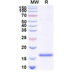 SDS-PAGE - Anti-Gephyrin Nanobody [SAA1333] (A338011) - Antibodies.com