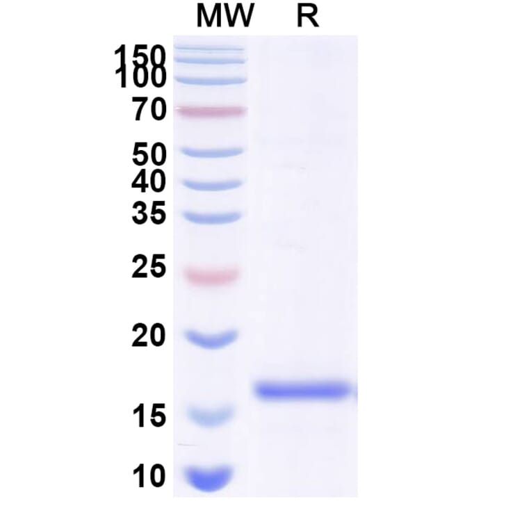 SDS-PAGE - Anti-Gephyrin Nanobody [SAA1333] (A338011) - Antibodies.com