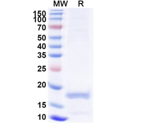 SDS-PAGE - Anti-Melanophilin Nanobody [SAA1233] (A338012) - Antibodies.com