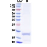 SDS-PAGE - Anti-Melanophilin Nanobody [SAA1233] (A338012) - Antibodies.com