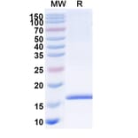 SDS-PAGE - Anti-SARS-CoV-2 Spike Protein Nanobody [SAA0871] (A338014) - Antibodies.com