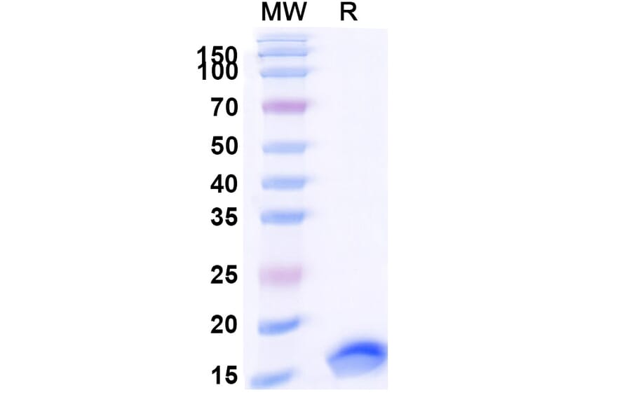 SDS-PAGE - Anti-SARS-CoV-2 Spike Protein Nanobody [SAA0885] (A338015) - Antibodies.com