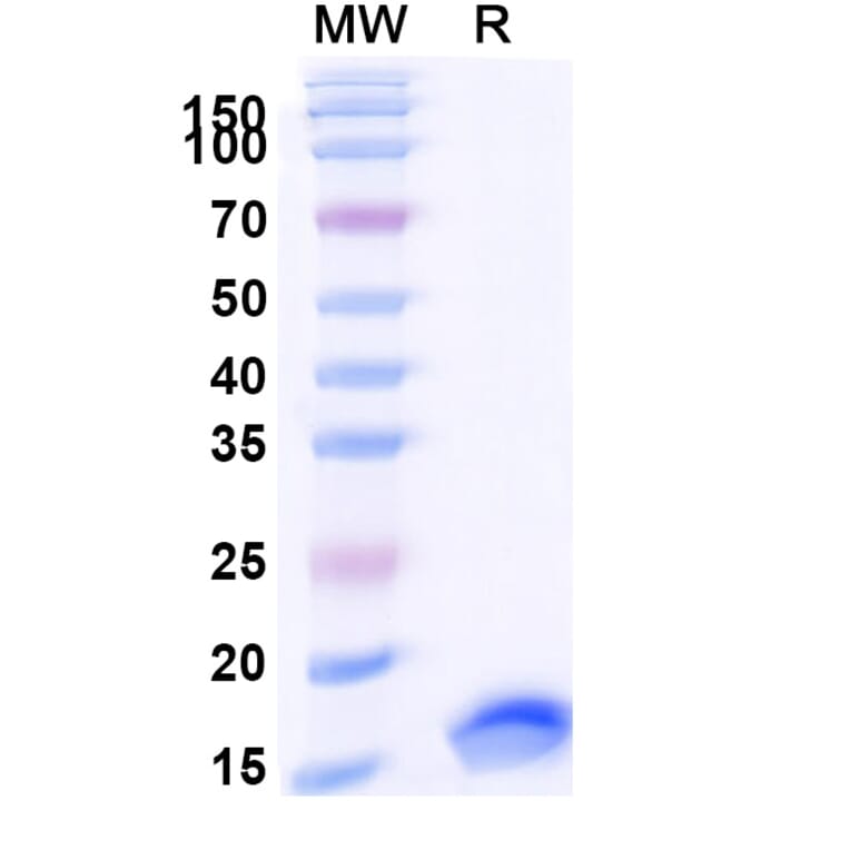 SDS-PAGE - Anti-SARS-CoV-2 Spike Protein Nanobody [SAA0885] (A338015) - Antibodies.com