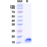 SDS-PAGE - Anti-SARS-CoV-2 Spike Protein Nanobody [SAA0885] (A338015) - Antibodies.com