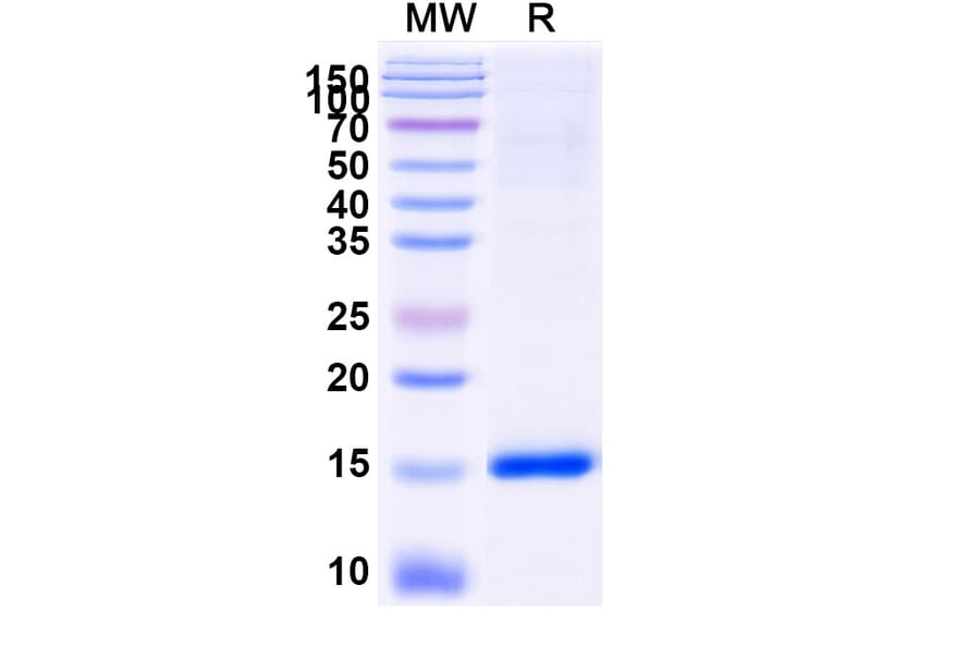 SDS-PAGE - Anti-SARS-CoV-2 Spike Protein Nanobody [SAA0886] (A338016) - Antibodies.com